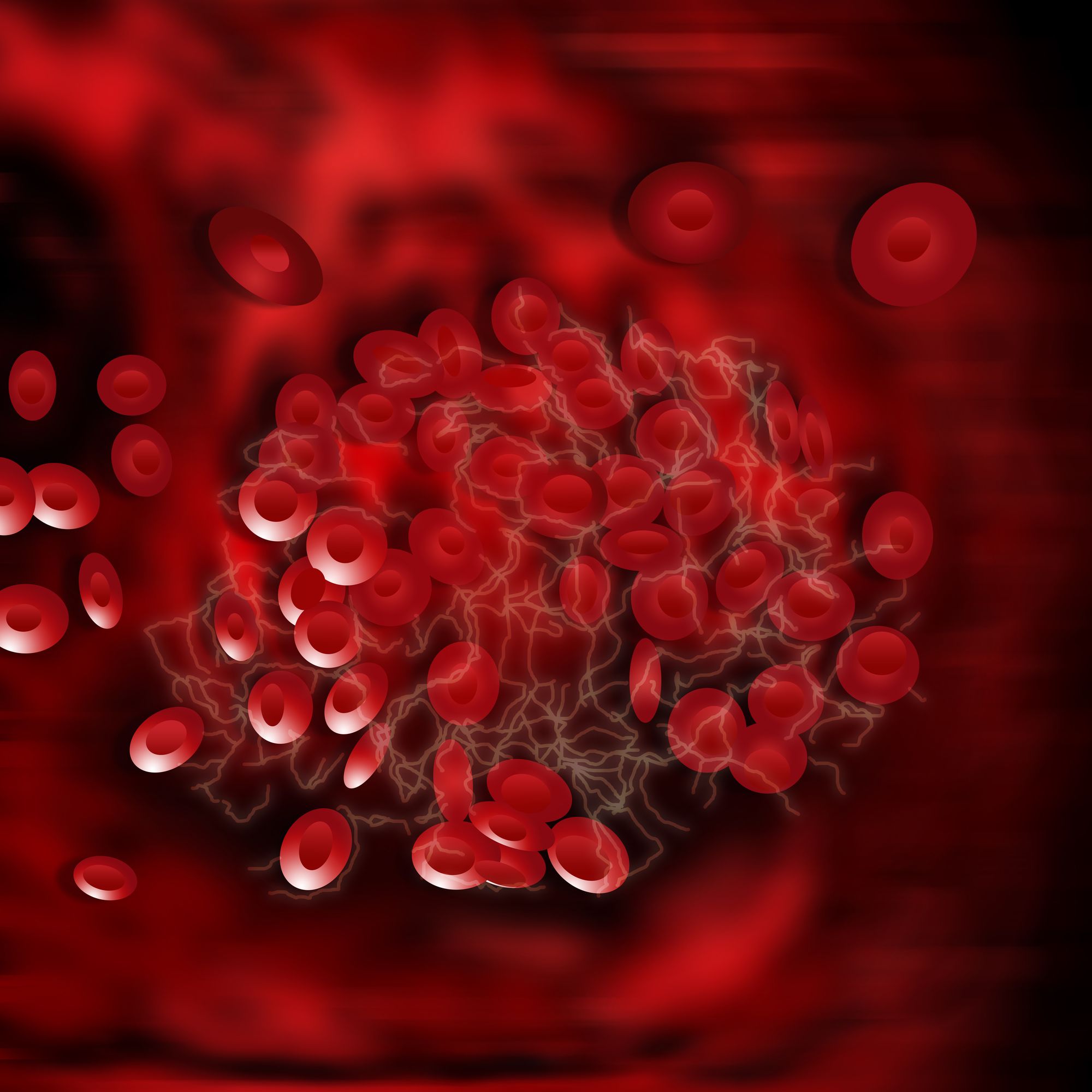 vein-filter-adverse-side-effects