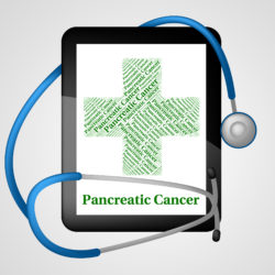 Pancreatic Cancer Onglyza