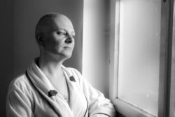 Bald woman cancer patient in the hospital