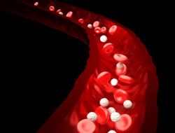 IVC filter complications