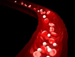 IVC filter complications