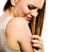 Stevens Johnson syndrome SJS toxic epidermal necrolysis TEN