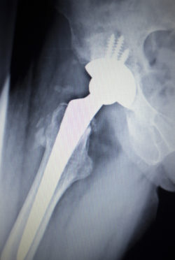 y tones. Scanned in orthopedics traumatology surgery hospital clinic.