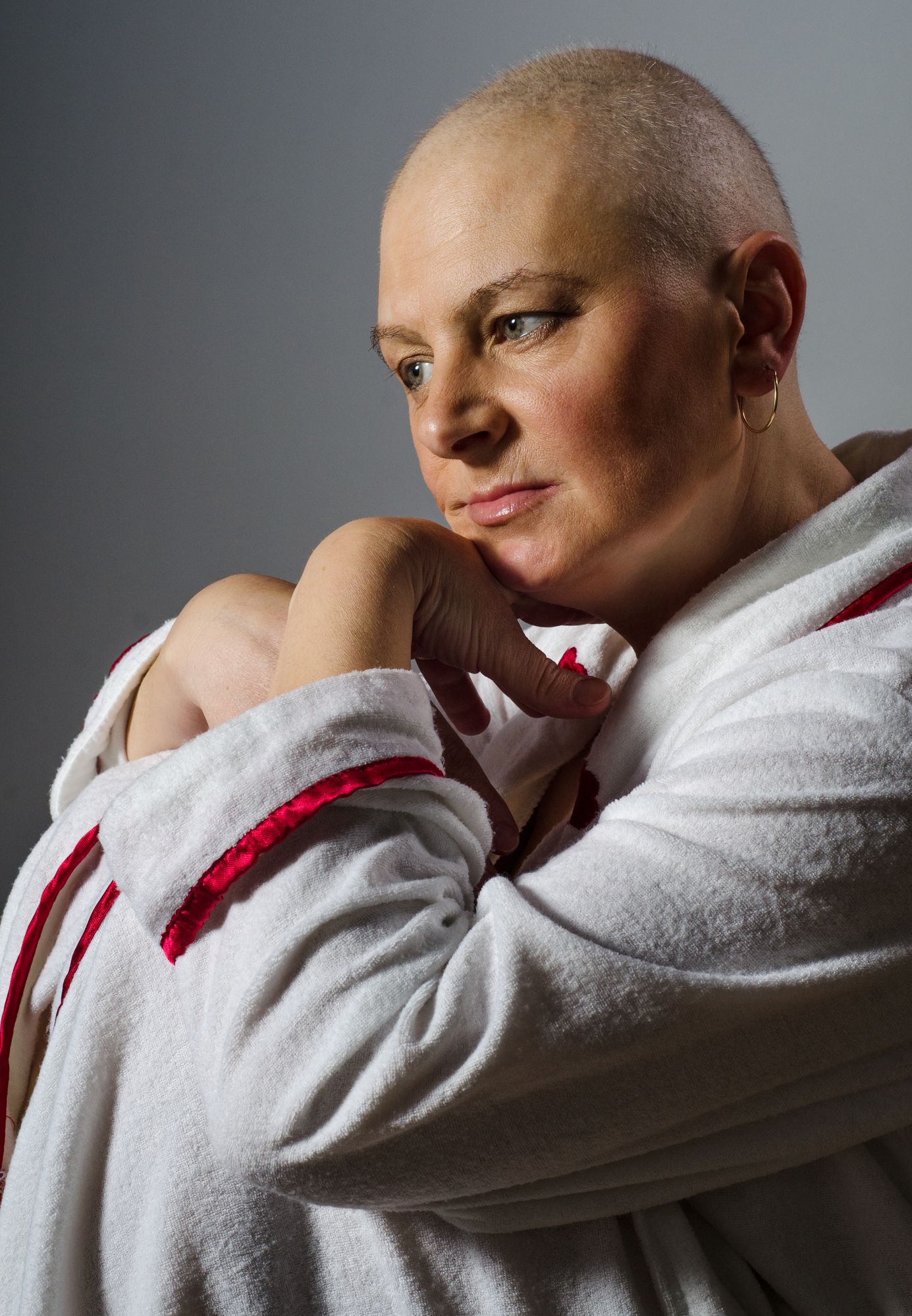 Category: Cancer/Alopecia Minoxidil 5% May Help Counter Radiation-Induced Hair Loss  main image 2