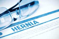 Hernia Mesh Lawsuit