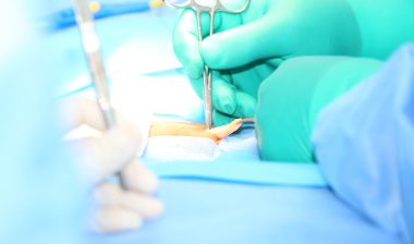 Open hernia surgery