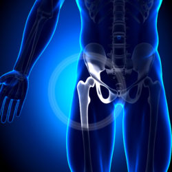 stryker-hip-recall