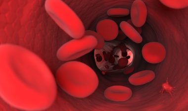 IVC filter complications blood cells
