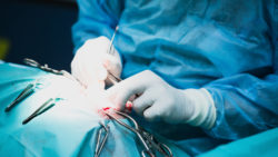 Hernia mesh complications hernia surgery