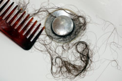 Hair loss
