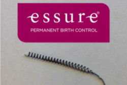 Essure-birth-control