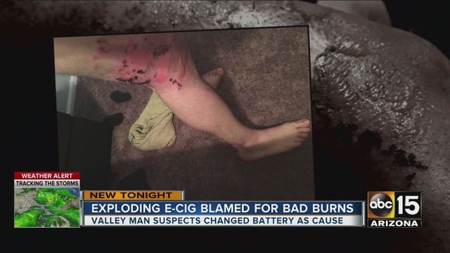 Electronic Cigarette Explosion Injures Az. Man - Top Class Actions