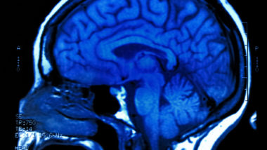 Dilantin side effects include cerebellar atrophy.