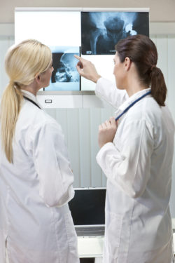 Stryker Accolade lawsuit hip implant hip replacement