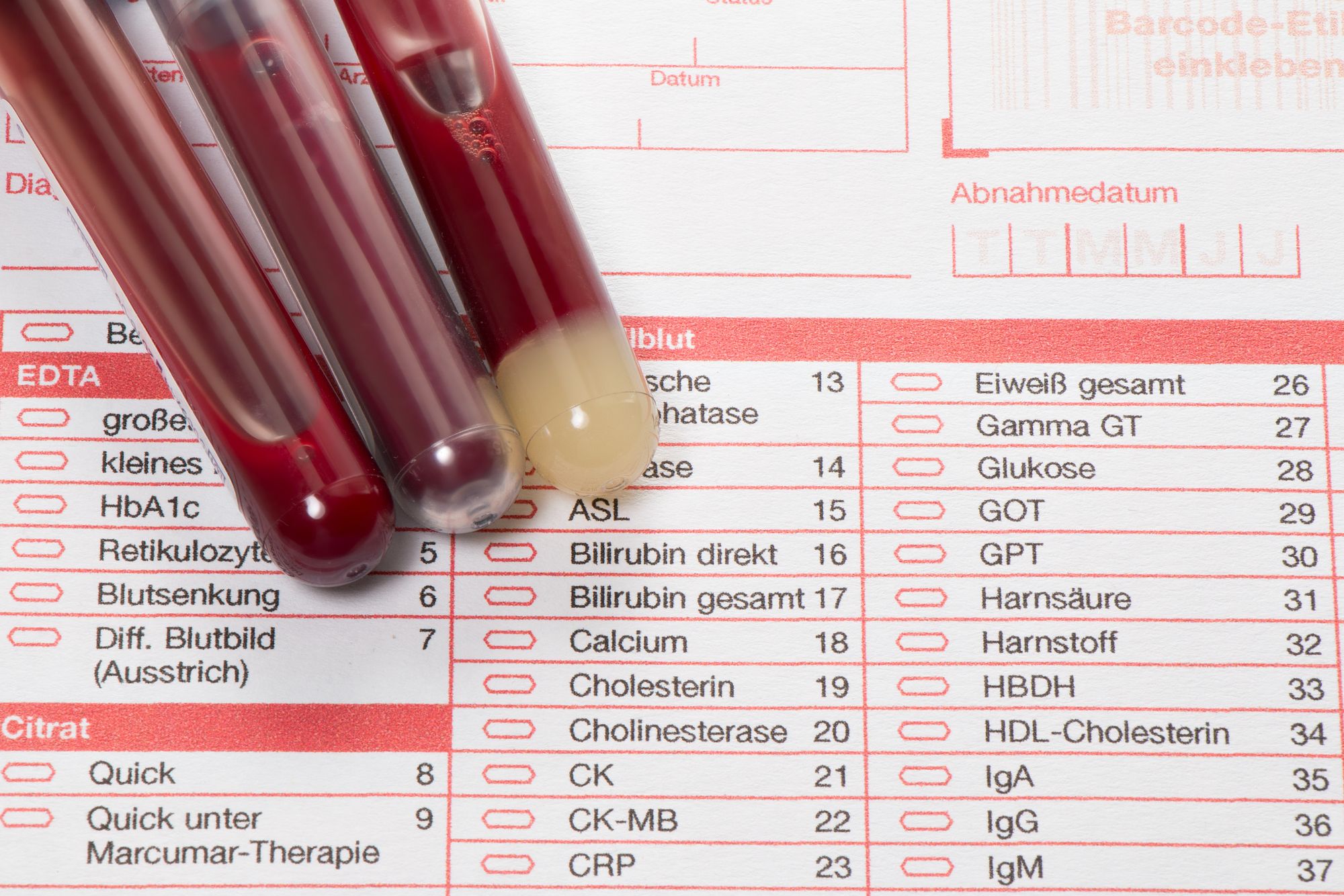 lab-tests-costs