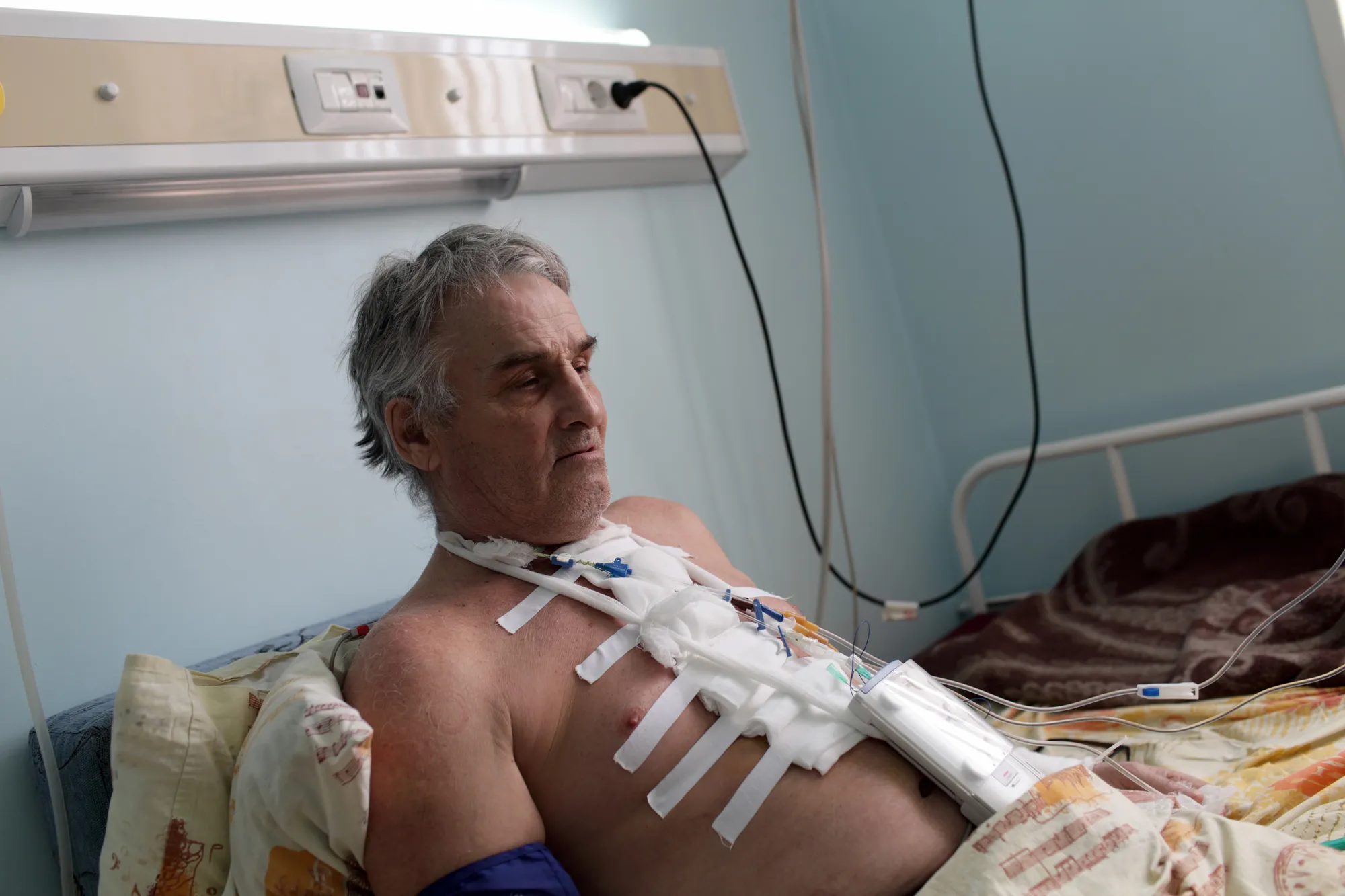 infection-after-open-heart-surgery