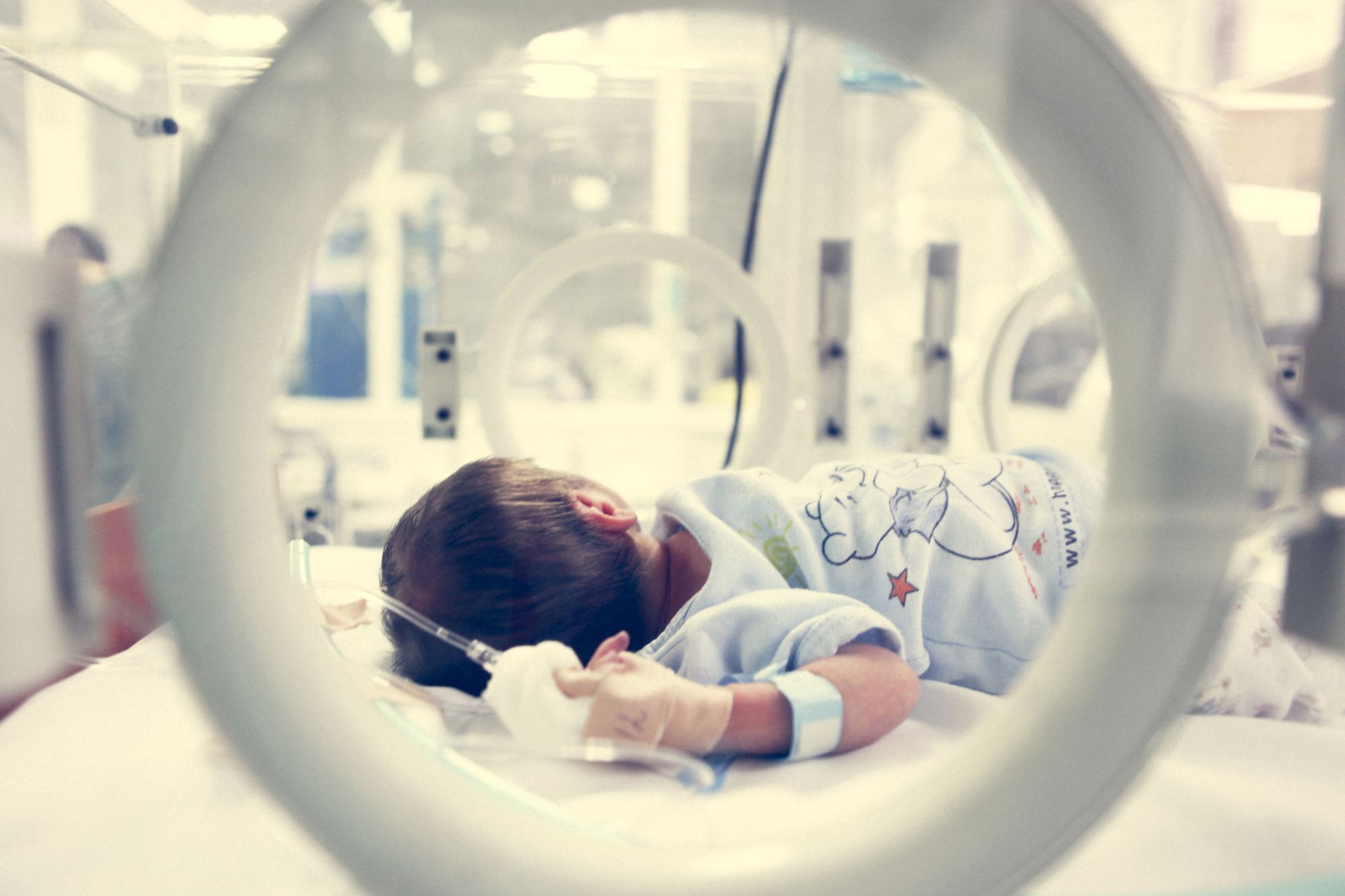 retinopathy-of-prematurity