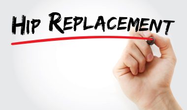 Zimmer DePuy hip replacement