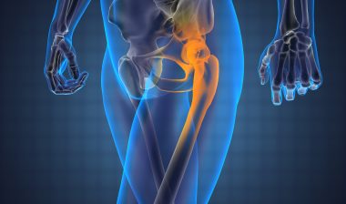 DePuy ASR Pinnacle Zimmer complications
