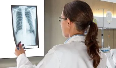 Celect IVC Filter lawsuit inferior vena cava filter