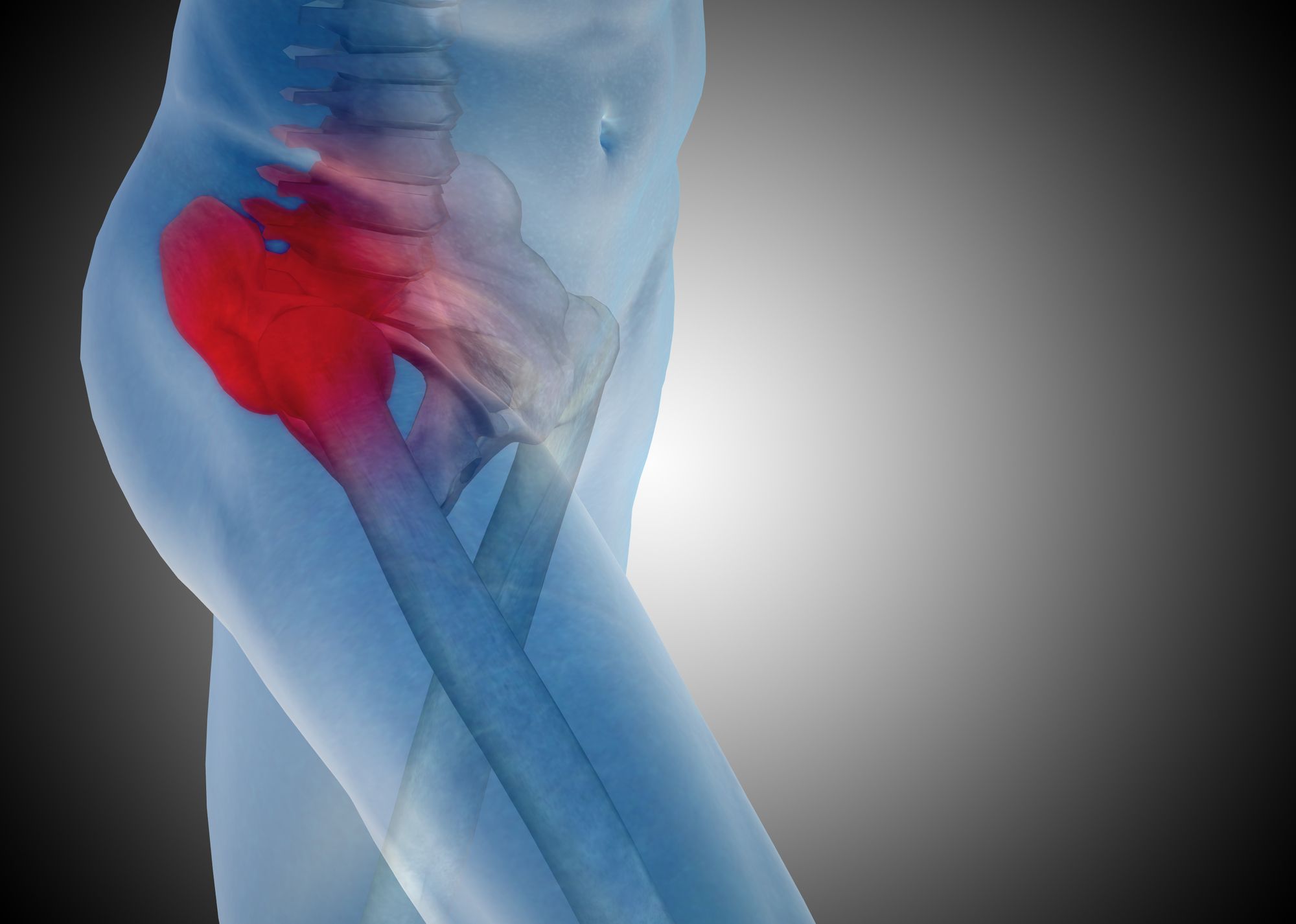DePuy-metal-hip-implant