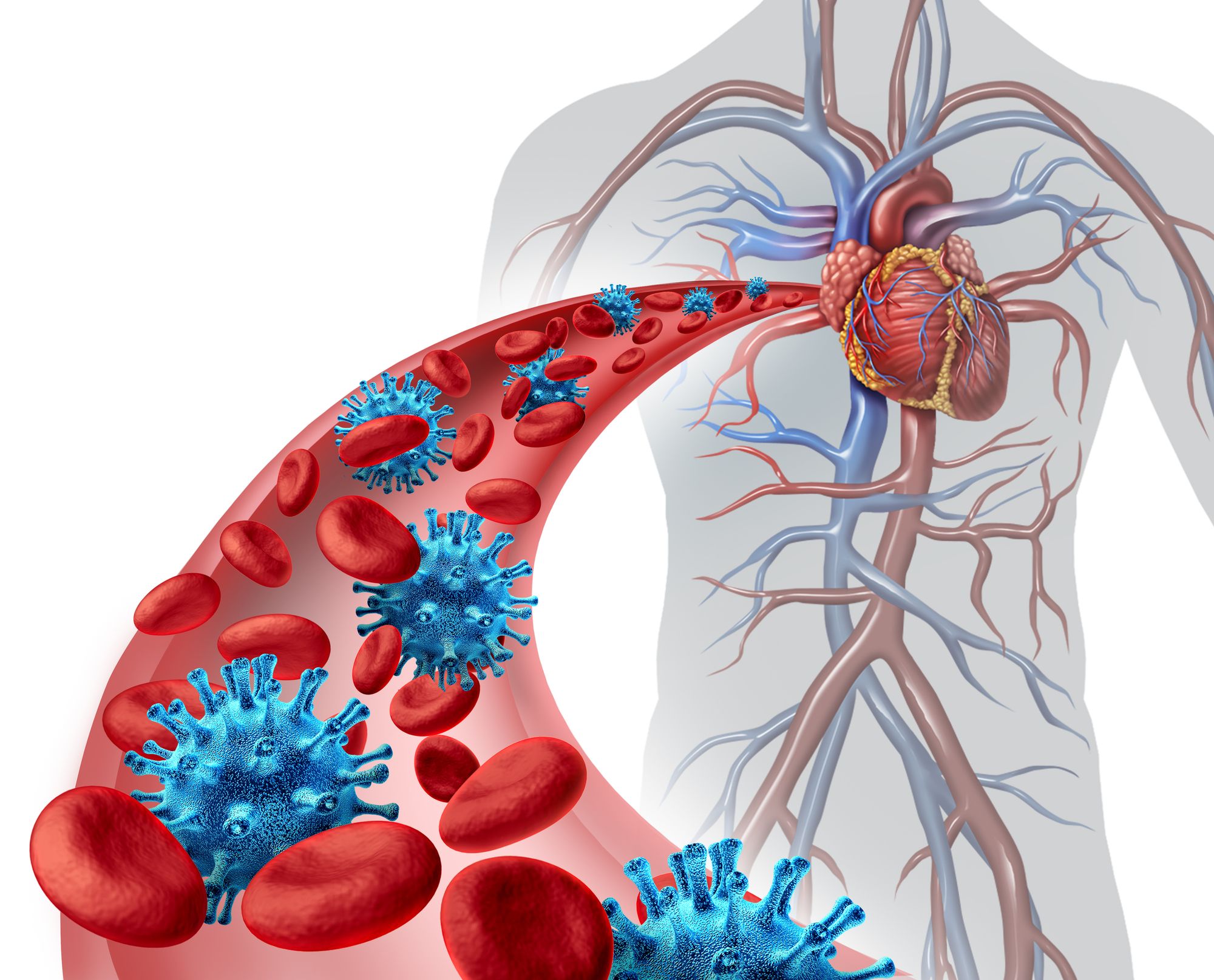 Infected Heart Surgery Device Exposed Hundreds of Patients to Bacteria