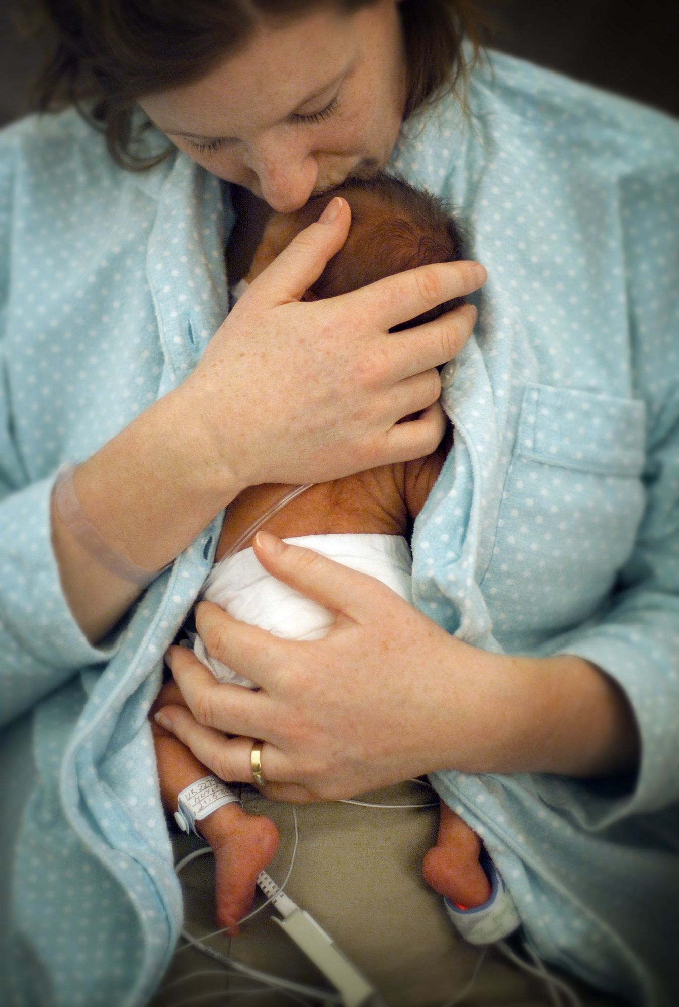 retina-of-prematurity