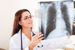 IVC filter complications