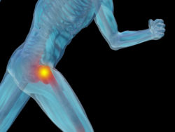 Stryker metal hip recall complications hip pain