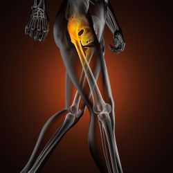 Zimmer DePuy hip implant revision