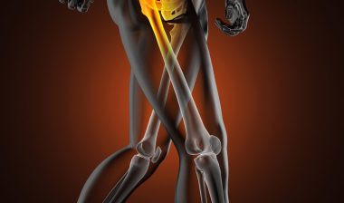 Zimmer DePuy hip implant revision