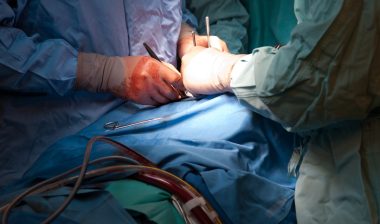 Close-up of surgeon hands performing surgery