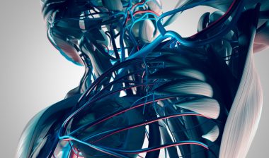 IVC filter, human torso