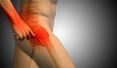Zimmer-Durom-hip-implant