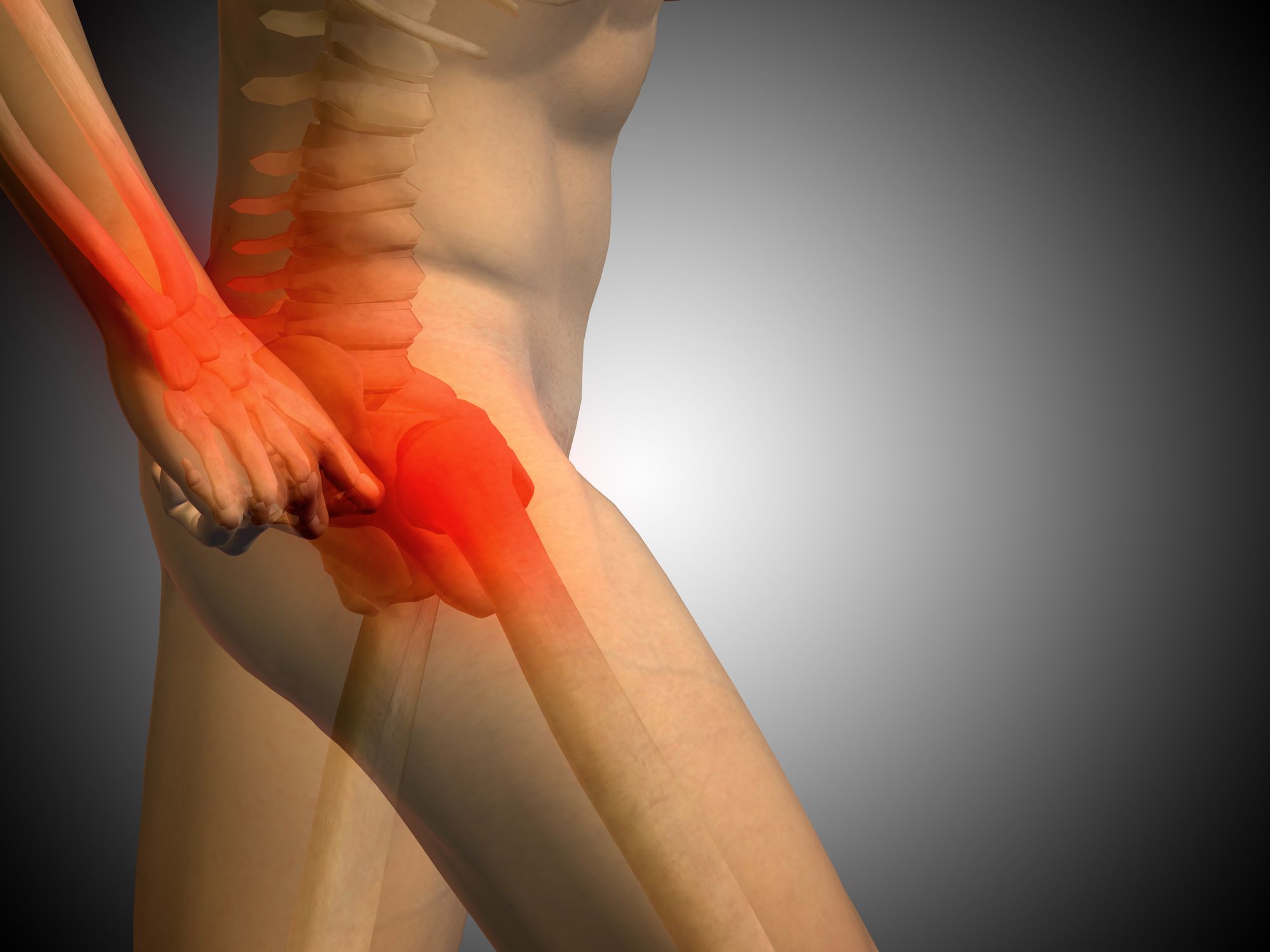 Zimmer-Durom-hip-implant