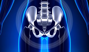 Uphold-Vaginal-Support-System
