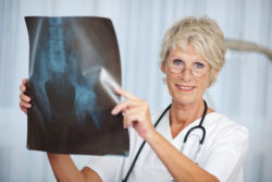 DePuy ASR hip implant doctor xray