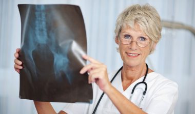 DePuy ASR hip implant doctor xray