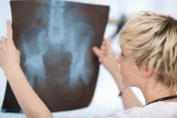 stryker hip implant complications recall