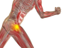 DePuy Zimmer hip implant hip replacement hip pain