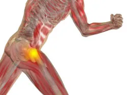 DePuy Zimmer hip implant hip replacement hip pain