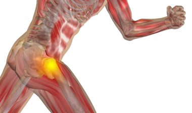DePuy Zimmer hip implant hip replacement hip pain