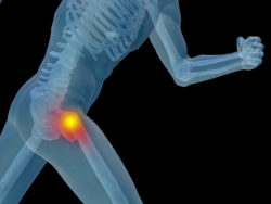 DePuy Pinnacle hip implant complications