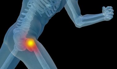 DePuy Pinnacle hip implant complications