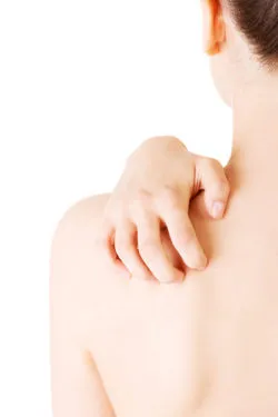 Stevens Johnson syndrome toxic epidermal necrolysis rash skin