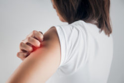 SJS Stevens Johnson syndrome rash