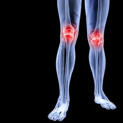 Zimmer-Persona-knee-problems