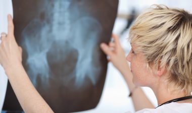 doctor looking at hip Xray report in hospital