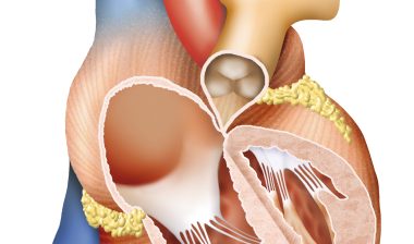 heart, ivc filter