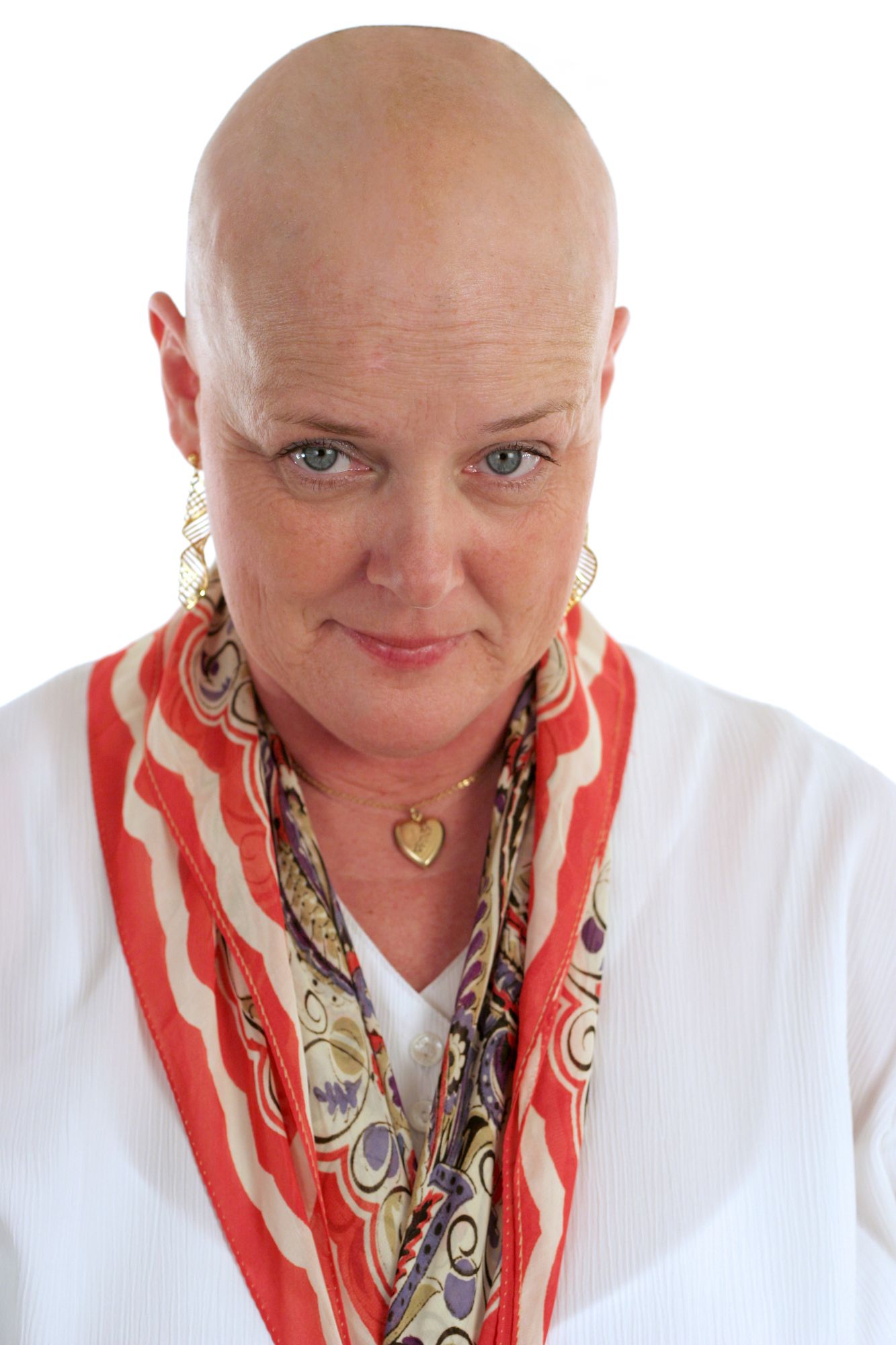 chemotherapy-hair-loss